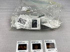 Vintage Medical Slides  Pediatric Infectious Disease   131 Slides