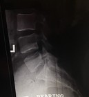 Medical X-ray Film Student Education Physician Spine Spinal Neck Skull 17  X 14 