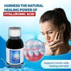 Gengigel Hyaluronic Acid Mouthrinse 150ml - Gum Healing  Oral Care Solution