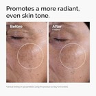 The Ordinary Glycolic Acid 7  Exfoliating Toner  Brightening And Smoothing Daily