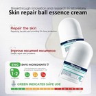 Mecncat Multi-effect Repair Care Roller Micro-molecular Essence   Improves Mu   