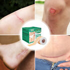 Scar Removal Silicone Tape For Hypertrophic Scars   Keloids  1 6   X59  