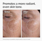 The Ordinary Glycolic Acid 7  Exfoliating Toner  Brightening And Smoothing Daily
