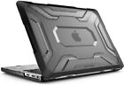 Supcase Case For Apple Macbook Pro 13 Inch  2020-2016 Release  Hard Bumper Cover
