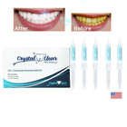 Blanqueador De Dientes Laser Gel Kit Profesional Dientes Blanqueamiento Dental
