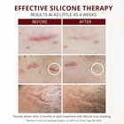 Healfast Silicone Scar Gel  Medical Grade Scar Cream For Surgical Scars