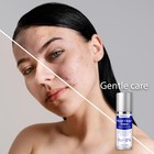 Scar Removal Cream Old Scars Stretch Mark Spots  Surgery  Burn  Injury Scar 55ml
