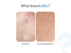 Bodywise 1  Salicylic Ceramide Body Wash   Exfoliating Barrier  Repair Skin Care
