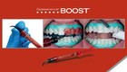 4750-us Ultradent Opalescence Boost 40  Whitening Intro Dental Kit 