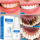 Teeth Whitening Essence Remove Plaque Stains Tooth Bleaching Serum Oral Hygiene