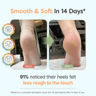 Urea Foot Cream 40  For Cracked Heels   Dry Feet  5 Oz   Gentle Exfoliating Crea