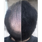 Samson Unisex Hair Building Fibers Refill Hair Loss Concealer Thin Bald Hair 25g