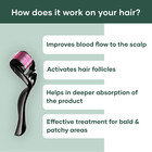 Derma Roller 0 5mm 540 Micro-needle skin Rejuvenation   Hair Regrowth Pack Of 10