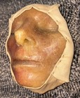 Antique Medical Moulage Late 1800- To Early 1900s European Museum Piece