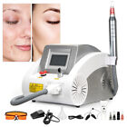 Q Switch Nd Yag Laser Machine For Tattoo Removal Skin Whitening And Rejuvenation