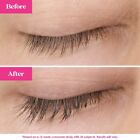Grande Lash-md Grande Lash Enhancing Serum 4ml 6 Month Supply Newest Authentic