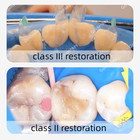 Clear Matrix Dental Anterior Posterior Transparent Bt Matrices Fit Bioclear