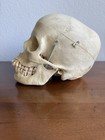 Vintage Kilgore International Human Skull With Springed Jaw With Case