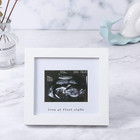 Baby Sonogram Photo Frame Ultrasound Picture Frame White