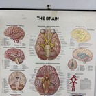 Vtg 1983 Anatomical Chart The Brain Poster 20x25