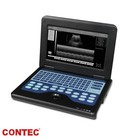 Portable Ultrasound Machine Laptop B-ultrasound Scanner Linear Convex 2 Probes