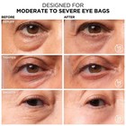 New  it  Cosmetics Bye Bye Under Eye Bags Rapid Bag Reducer 0 5 Oz    15 Ml