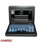 Digital Portable Ultrasound Machine Laptop Scanner   2 Probes  convex   Linear 