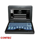 Digital Portable Ultrasound Machine Laptop Scanner With 3 5mhz Convex Probe Ce