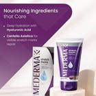Mederma Stretch Marks Therapy  50g