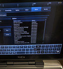 Ge Vivid Iq  Portable Cardiac Ultrasound System   M5sc-rs Probe Tested