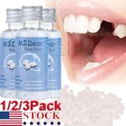3 1x Dental Thermal Fitting Beads Teeth Veneers Moldable Temporary Tooth Repair