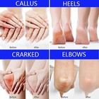 Urea Cream Foot Cream  40 Percent Foot Care Lotion For Cracked Heels moisturizin