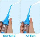  Non Electric Water Flosser Dental Oral Irrigator Water Floss Pick Teeth Cleaner