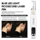Handheld Picosecond Laser Pen Tattoo Scar Removal Machine Skin Beauty Device