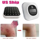 Lastek 36 Lllt Laser Beams Therapy Device Pain Relief Wound Healing Mastitis
