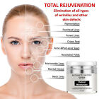 Retinol Serum Moisturizer Night Cream In Hyaluronic Acid-face Eye Organic Lotion