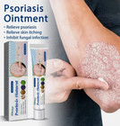 4 X Psoriasis Dermatitis Eczema Natural Cream Skin Treatment Ointment