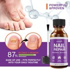 Maximum Strength Nail Fungus Treatment  Toe Fungus Nail Treatment  1oz