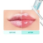 Dr  Melaxin Bp Spicule Plumping Lip Shot     Liquid Microneedling Lip Plumper  4ml