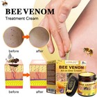 Lovilds Bee Venom All-in-one Cream  2025 New Bee Venom Skin Treatment Cream 50ml