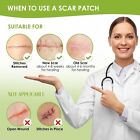 Silicone Scar Sheets 1 6 x 120  Roll-3m   Silicone Scar Tape  Scar Strips  Pr   
