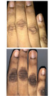 Dark Knuckle Skin Whitening Lightening Kojic Acid  Glycolic Acid  Aha Cream