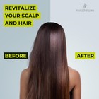 Tea Tree Shampoo   Conditioner Set 16oz Anti Dandruff Itchy Scalp Rosemary Oil