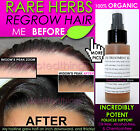 Best Super Fast Hair Growth System Natural Hair Growth Products Kit Of 3