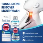 1-20pc Tonsil Stone Remover Mouthwash Natural Oral Rinse Fresh Breath Treatment