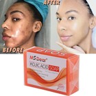 Kojic Acid Soap Dark Spot Remover Skin Lightening Face Whitening Body Bleaching