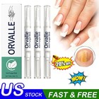 Orville Anti Fungal Pen Intensive Treatment Toenail Fungus Foot Nail Repair Oil
