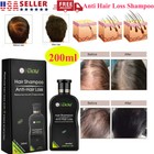 Hair Growth Shampoo Hair Regrowth Treatment Anti-hair Loss Shampoo For Men women