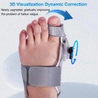 Bunion Fix Toe Valgus Corrector Big Toe Straightener Adjustable For Men   Women
