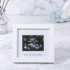 Baby Sonogram Photo Frame - Ultrasound Picture Frame For Expecting Parents  B   